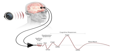 Cognision